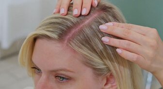 Suchá pokožka hlavy - hlavné príčiny a účinné riešenia