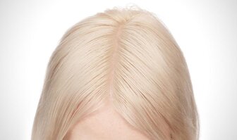 Čo spôsobuje svrbenie pokožky hlavy a ako mu predchádzať?