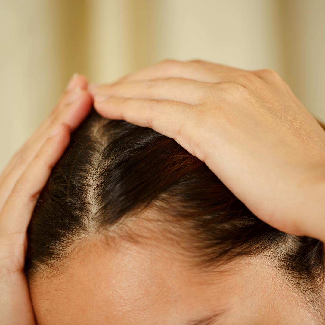 Vypadávanie vlasov príčiny